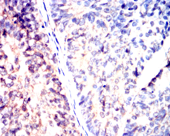 MMP13 Antibody