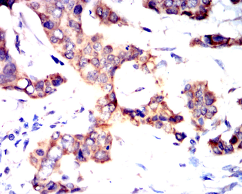 CREBBP Antibody