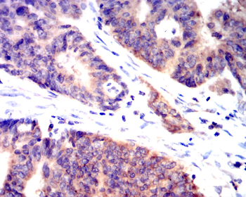 CREBBP Antibody