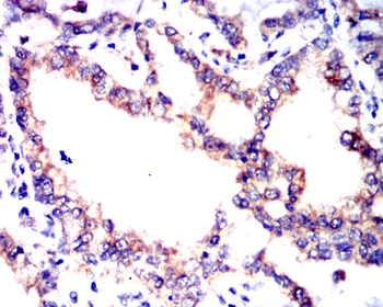 CREBBP Antibody