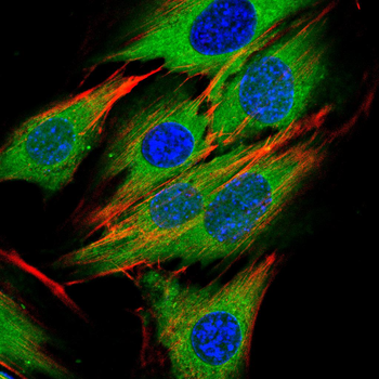 NOTCH2 Antibody