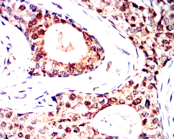 NOTCH2 Antibody