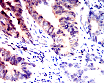 NOTCH2 Antibody