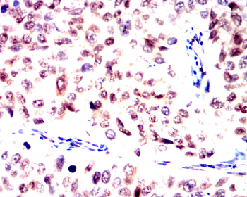 NOTCH2 Antibody