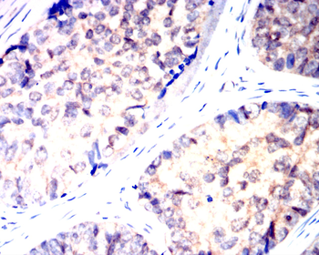 NOTCH2 Antibody