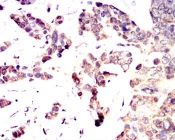 FABP4 Antibody