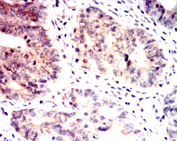 FABP4 Antibody