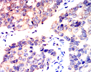 FABP4 Antibody