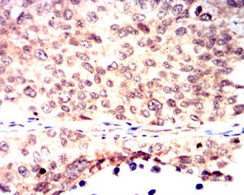 FABP4 Antibody