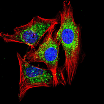 AQP2 Antibody