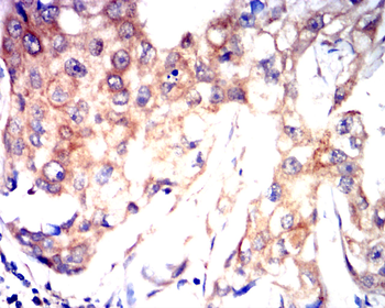 AQP2 Antibody