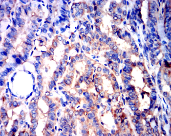 AQP2 Antibody