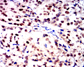 TGFB3 Antibody