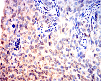 TGFB3 Antibody