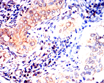 JAK3 Antibody