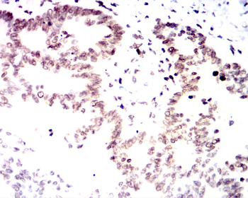 CDKN2B Antibody