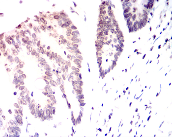 ETV4 Antibody