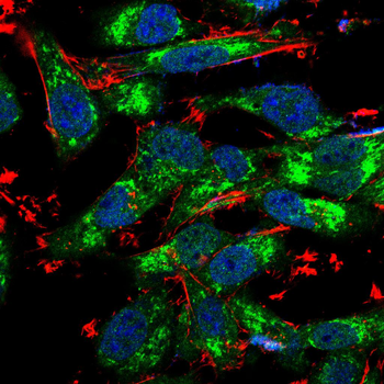 ASS1 Antibody