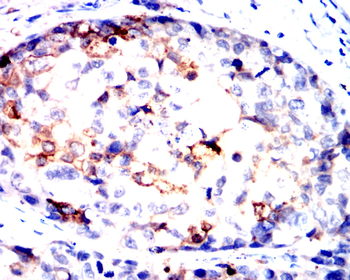 CD276 Antibody