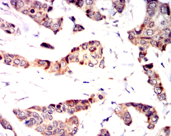 ACP5 Antibody