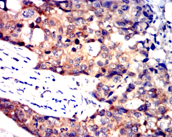SST Antibody