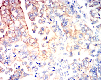 SST Antibody