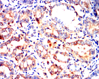 SST Antibody