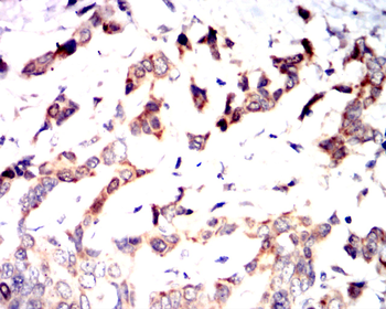 SETDB1 Antibody