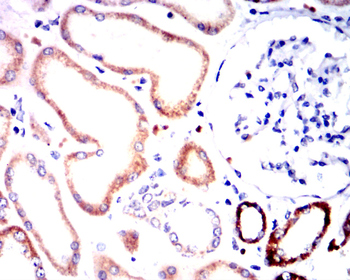 DDR2 Antibody