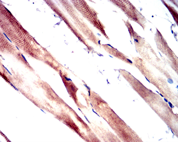 DDR2 Antibody