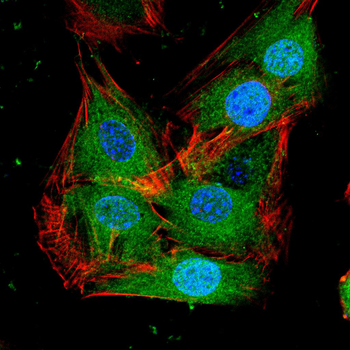 RICTOR Antibody