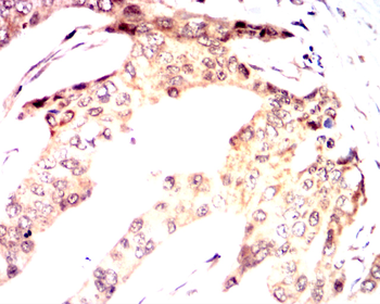 RICTOR Antibody