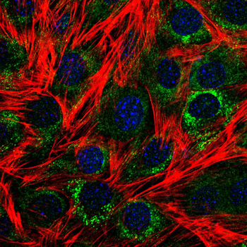 NTRK1 Antibody