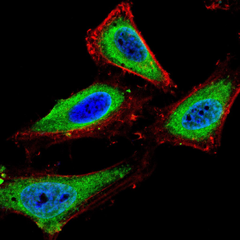 MMP13 Antibody
