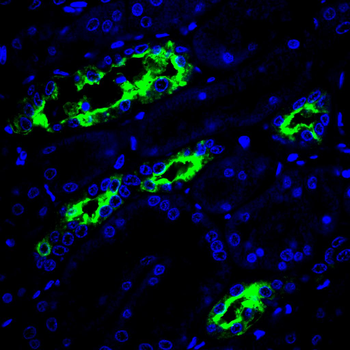 AQP2 Antibody