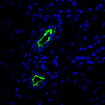 AQP2 Antibody