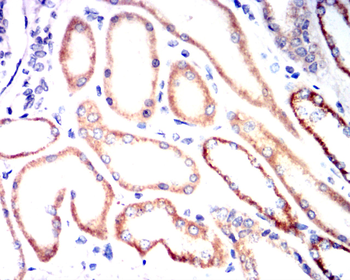 AQP2 Antibody