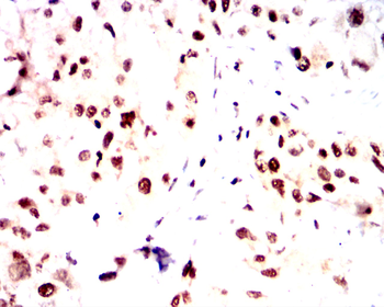CDKN2B Antibody