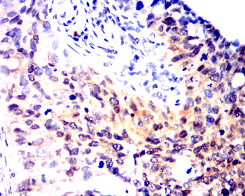 CDKN2B Antibody