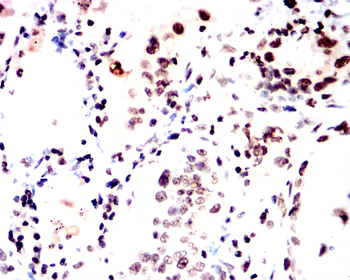 CDKN2B Antibody