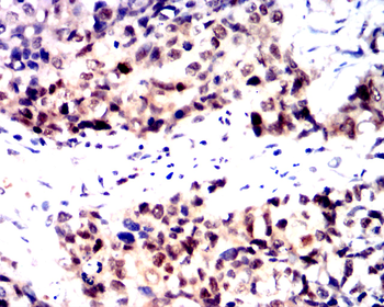 CDKN2B Antibody