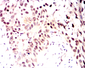 OTX2 Antibody