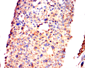 IGF2 Antibody