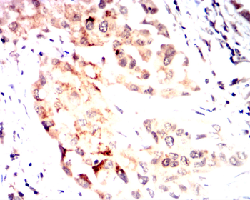 IGF2 Antibody