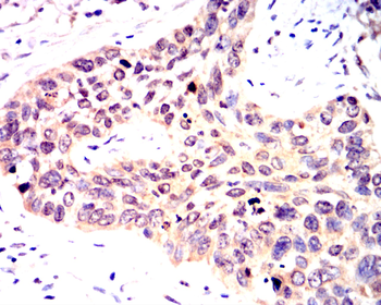 GSK3B Antibody