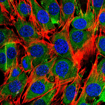 NME1 Antibody