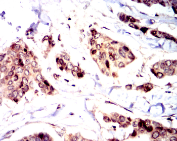 NME1 Antibody
