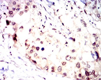 NME1 Antibody