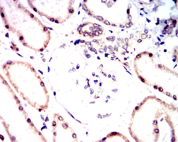 NME1 Antibody
