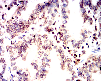 NME1 Antibody